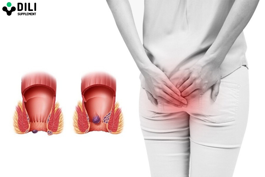 dấu hiệu của bệnh táo bón nặng là gì