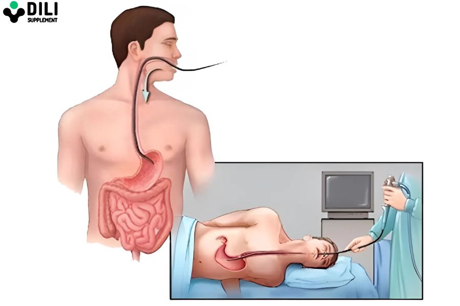 viêm dạ dày hp 6