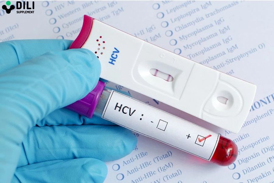 viêm dạ dày hp âm tính 1