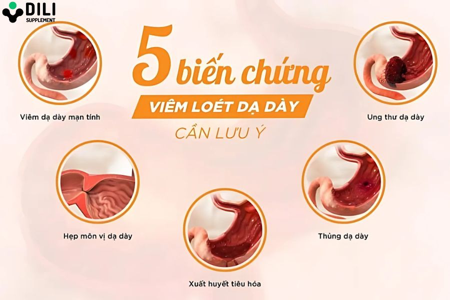 viêm dạ dày mạn tính 3