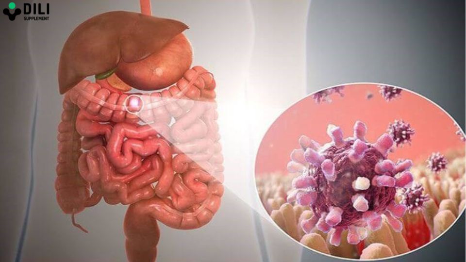 viêm dạ dày ruột là gì