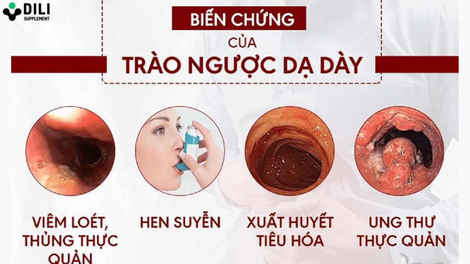 biến chứng trào ngược dạ dày thực quản