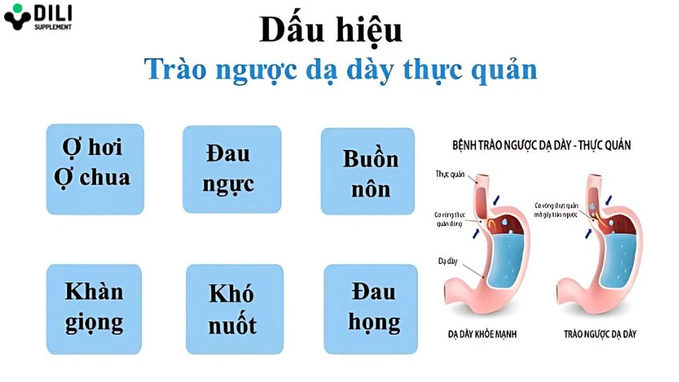 dấu hiệu trào ngược dạ dày thực quản