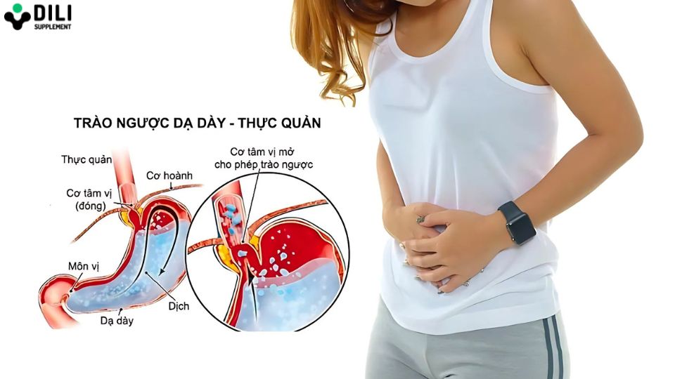 trào ngược dạ dày gây ho 3