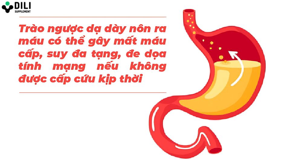 trào ngược dạ dày nôn ra máu 1