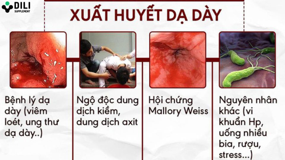 trào ngược dạ dày nôn ra máu 2