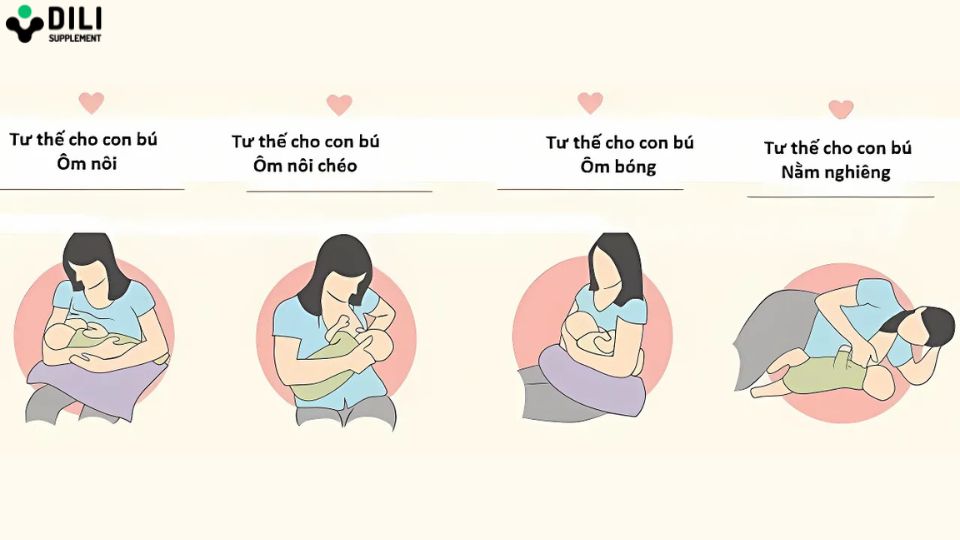 trẻ sơ sinh bị trào ngược dạ dày điều trị