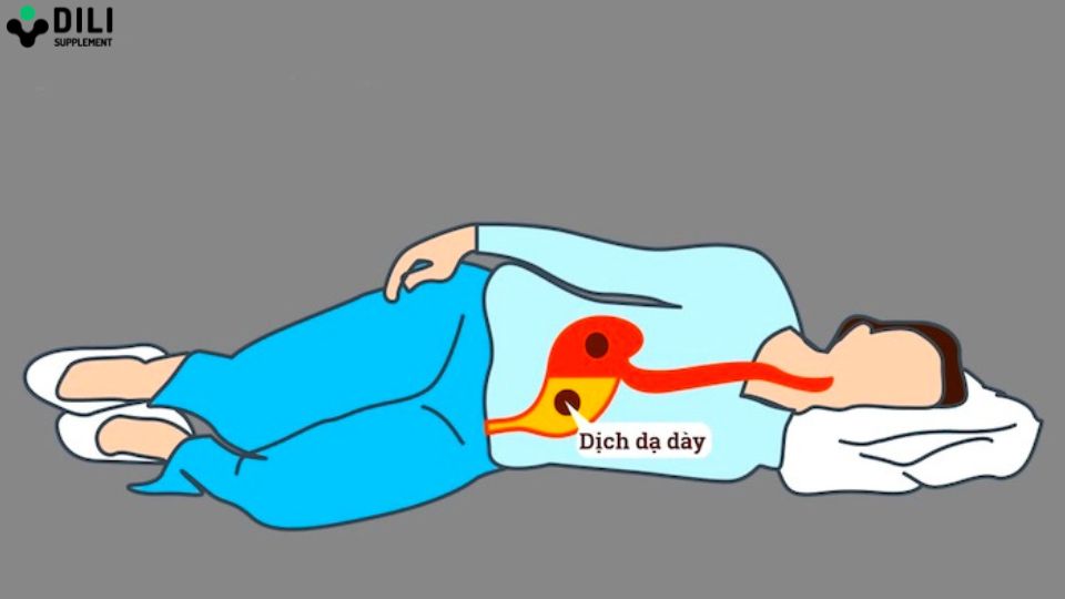 cách chữa buồn nôn sau khi uống bia nằm nghiêng