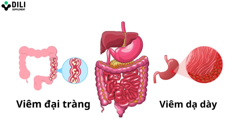 cách trị đau bụng sau khi uống bia 1 