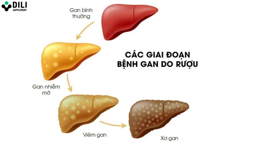 uống bia nhiều bị gì 2