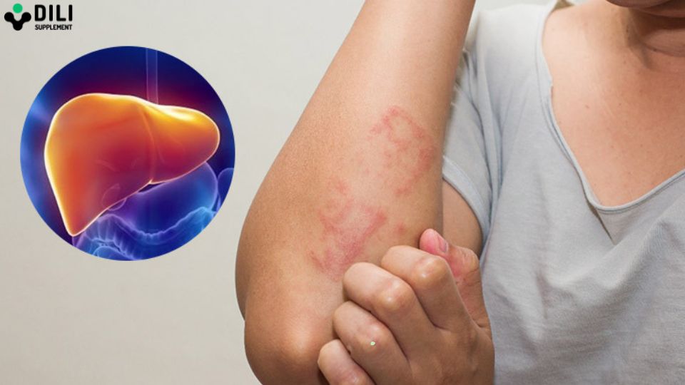 chỉ số men gan cao bao nhiêu là nguy hiểm 3